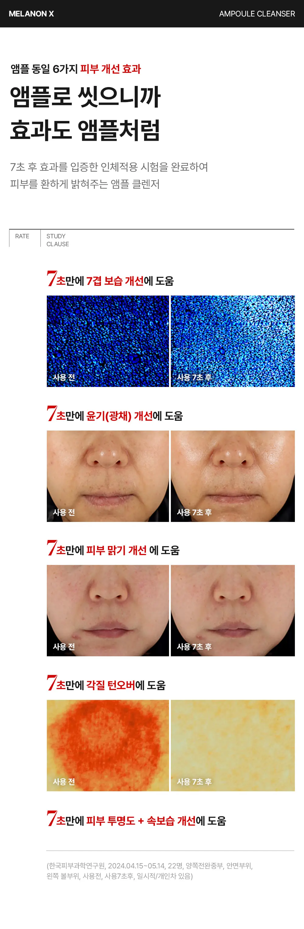 [스킨케어링클렌저] 메디필 멜라논 엑스 앰플 클렌저 150ml 상세페이지 11